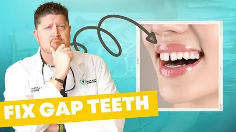 Gap Teeth Insults