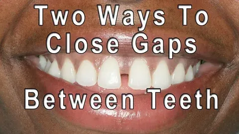 Tooth Gap Puns Captions